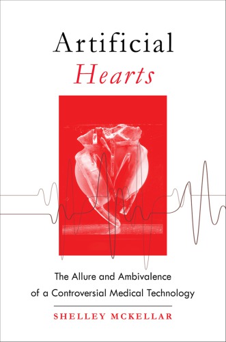 Artificial Hearts: The Allure and Ambivalence of a Controversial Medical Technology