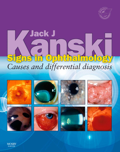 Signs in ophthalmology : causes and differential diagnosis