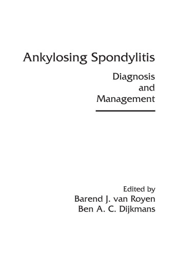 Ankylosing Spondylitis: Diagnosis and Management