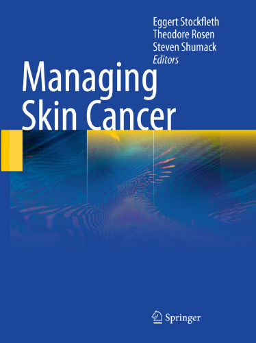 Managing Skin Cancer