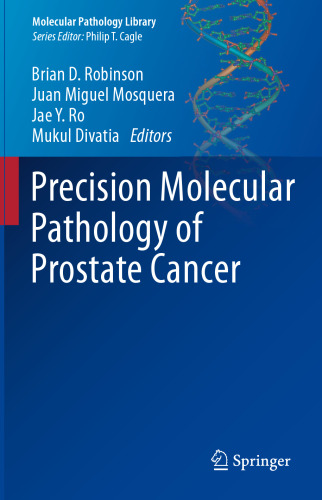  Precision Molecular Pathology of Prostate Cancer