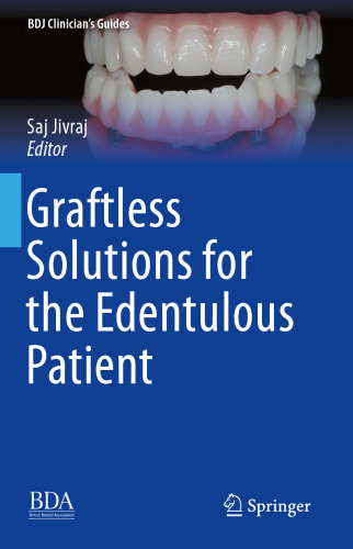  Graftless Solutions for the Edentulous Patient