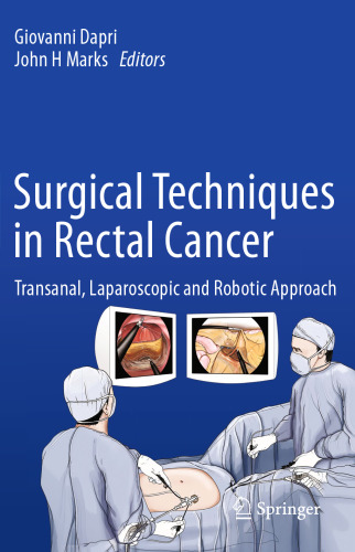 Surgical Techniques in Rectal Cancer: Transanal, Laparoscopic and Robotic Approach