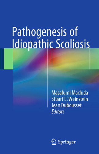  Pathogenesis of Idiopathic Scoliosis