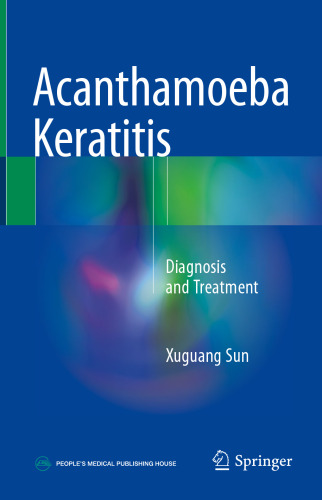  Acanthamoeba Keratitis: Diagnosis and Treatment