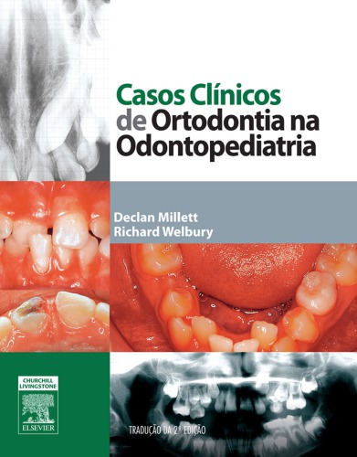 Casos Clínicos de Ortodontia na Odontopediatria