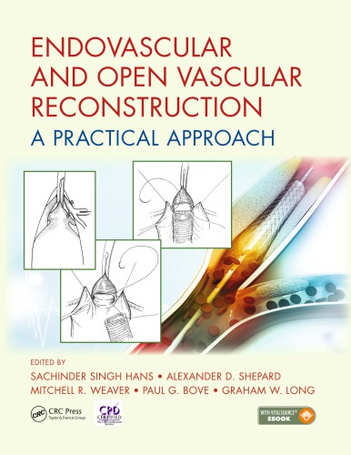 Endovascular and Open Vascular Reconstruction : A Practical Approach