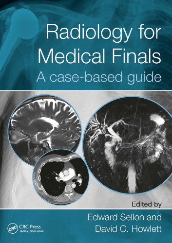 Radiology for Medical Finals A Case-based Guide