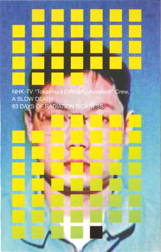 A Slow Death: 83 Days of Radiation Sickness