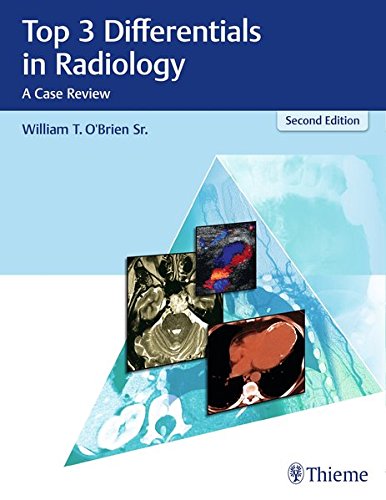 Top 3 Differentials in Radiology: A Case Review