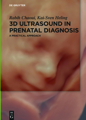 3D Ultrasound in Prenatal Diagnosis: A Practical Approach