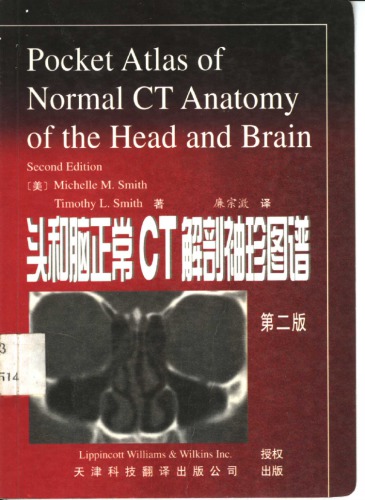 头和脑正常CT解剖袖珍图谱