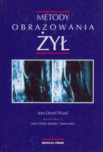 Metody obrazowania żył