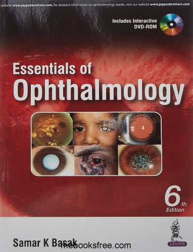 Essentials of Ophthalmology