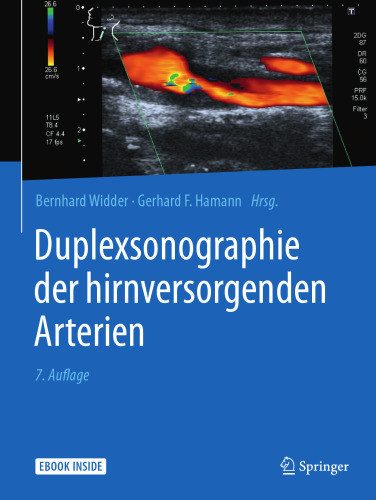 Duplexsonographie der hirnversorgenden Arterien