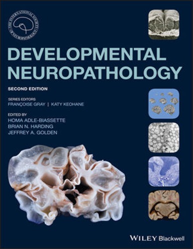 Developmental neuropathology