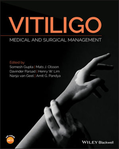 Vitiligo : medical and surgical management