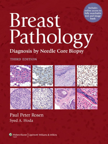 Breast Pathology: Diagnosis by Needle Core Biopsy