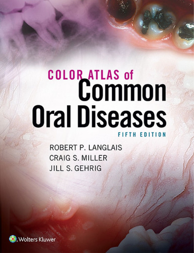Color Atlas of Common Oral Diseases