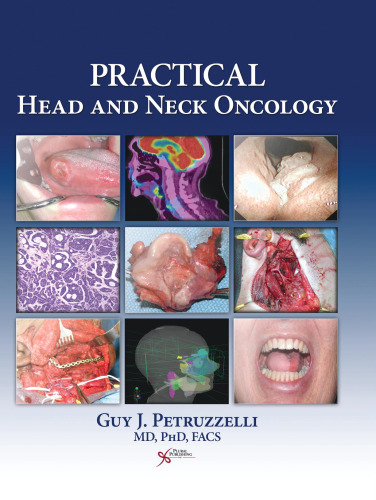 Practical Head and Neck Oncology