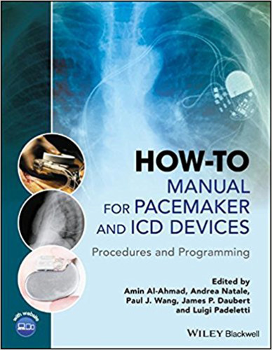 How-to Manual for Pacemaker and ICD Devices: Procedures and Programming