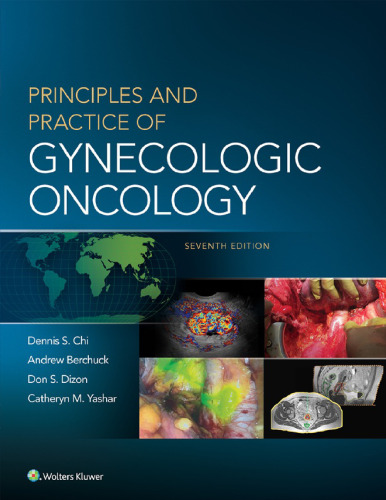 Principles and Practice of Gynecologic Oncology