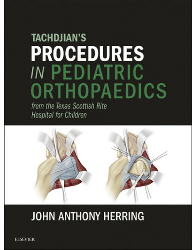 Tachdjian’s Procedures in Pediatric Orthopaedics: From the Texas Scottish Rite Hospital for Children