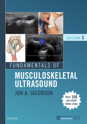 Fundamentals of Musculoskeletal Ultrasound