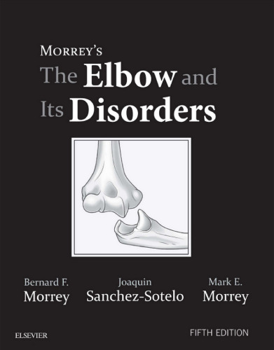 Morrey’s The Elbow and Its Disorders