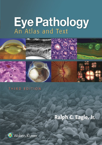 Eye Pathology: An Atlas and Text