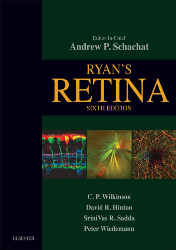 Ryan’s Retina