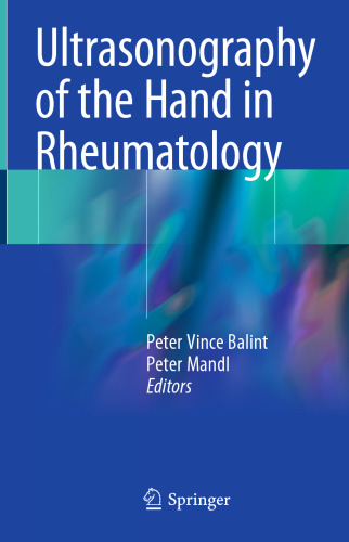 Ultrasonography of the Hand in Rheumatology