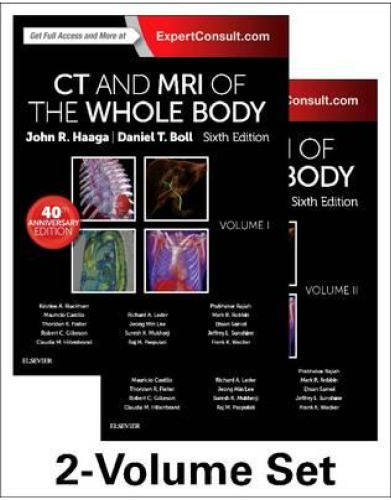 CT and MRI of the Whole Body, 2-Volume Set, 6e, Volume I