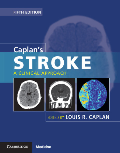 Caplan’s Stroke: A Clinical Approach