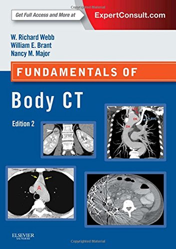 Fundamentals of Body CT, 4e