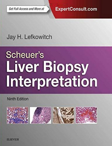 Scheuer’s Liver Biopsy Interpretation, 9e