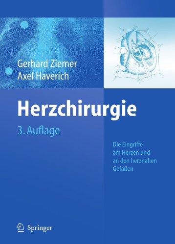 Herzchirurgie : Die Eingriffe Am Herzen Und an Den Herznahen Gefaaen.