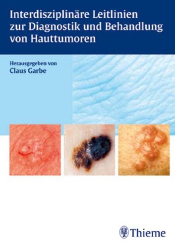 Interdisziplinäre Leitlinien zur Diagnostik und Therapie von Hauttumoren