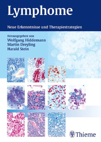Lymphome : neue Erkenntnisse und Therapiestrategien ; 68 Tabellen