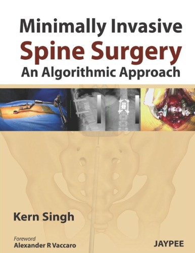 Minimally Invasive Spine Surgery: An Algorithmic Approach