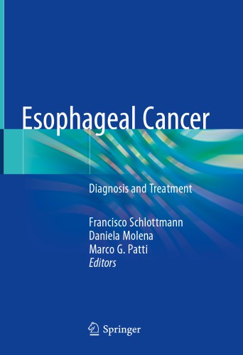 Esophageal Cancer Diagnosis and Treatment