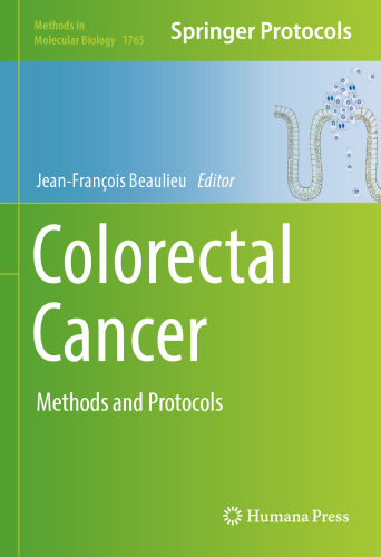 Colorectal Cancer