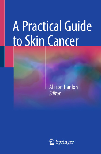 A Practical Guide to Skin Cancer