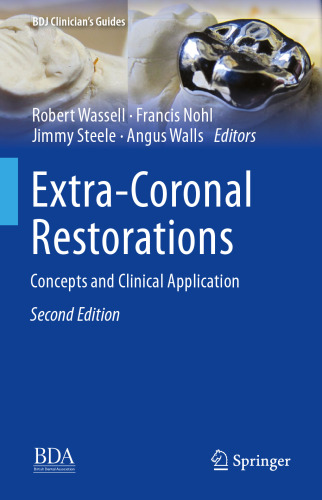 Extra-Coronal Restorations