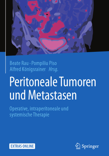 Peritoneale Tumoren und Metastasen