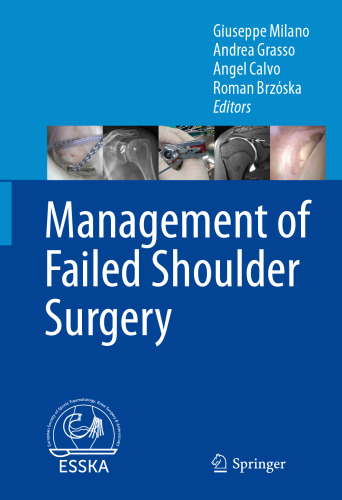 Management of Failed Shoulder Surgery