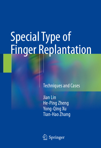Special Type of Finger Replantation