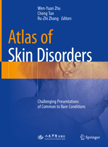 Atlas of Skin Disorders