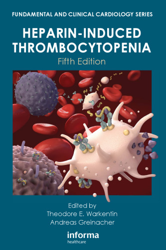 Heparin-induced thrombocytopenia