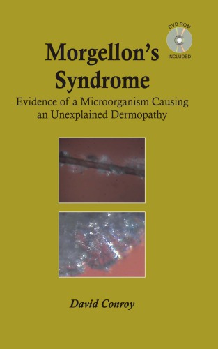 Morgellon’s syndrome: evidence of a microorganism causing an unexplained dermopathy